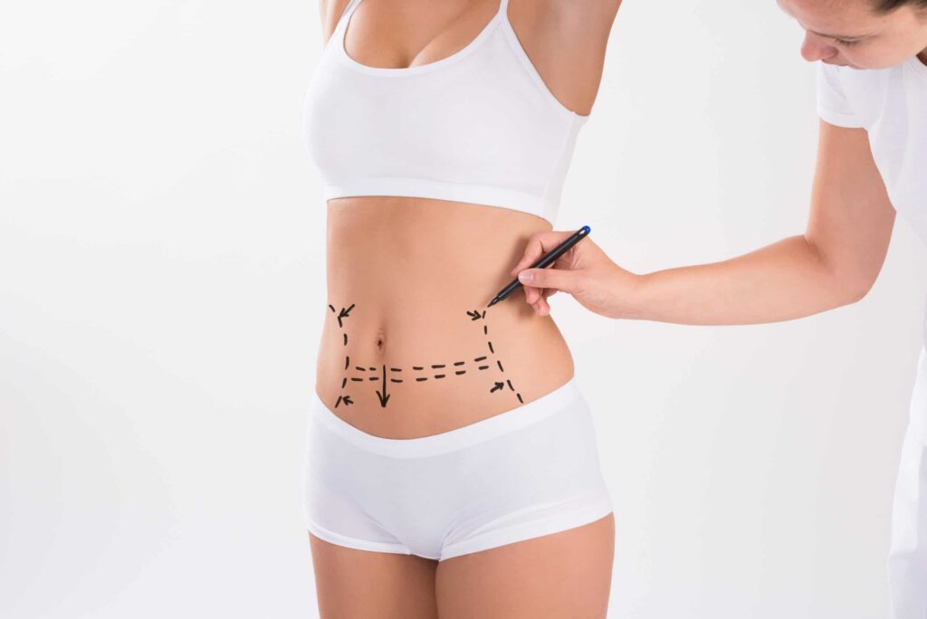tummy tuck Tummy Tuck - Fall River, MA | Plastic Surgery of Southern New England