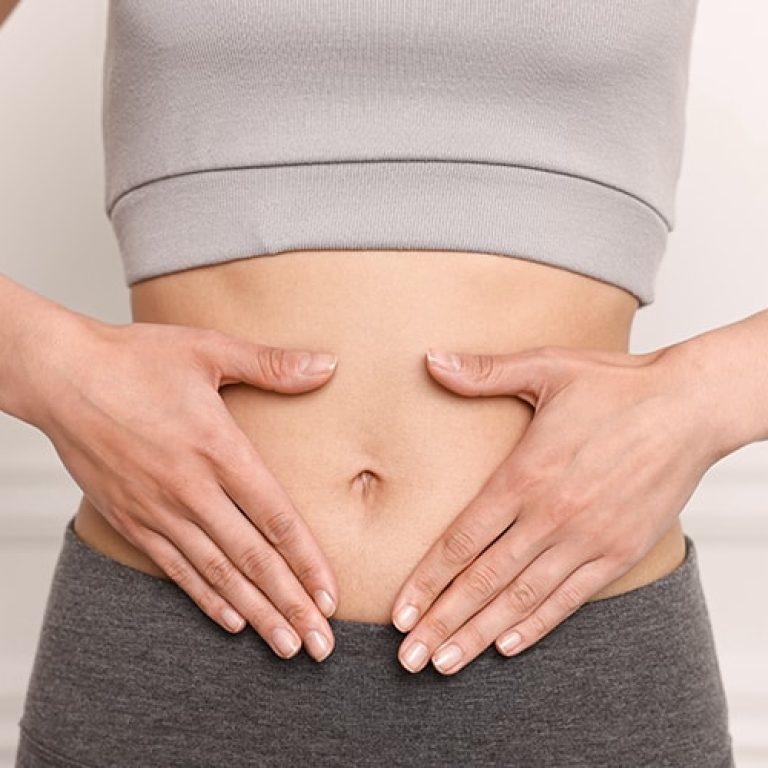 Diastasis